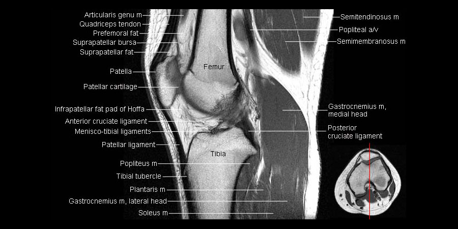Mri Anatomy Of Knee Joint How To Read An MRI Of The Knee An