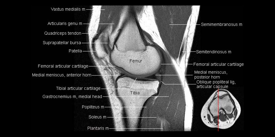 Knee Knee