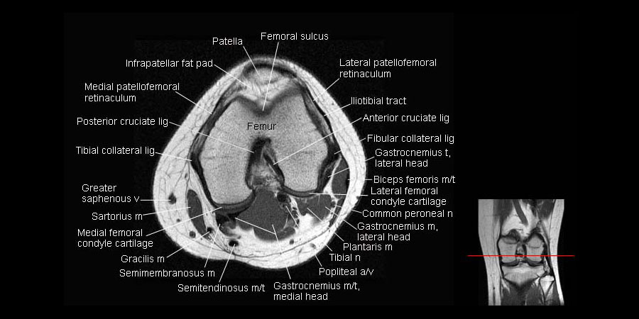 【ポイント10倍】 Knee 健康・医学